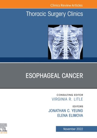 Esophageal Cancer, An Issue of Thoracic Surgery Clinics 1st Edition - Original PDF