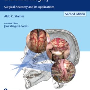 Transnasal Endoscopic Skull Base and Brain Surgery 2nd Edition Surgical Anatomy and its Applications - Original PDF