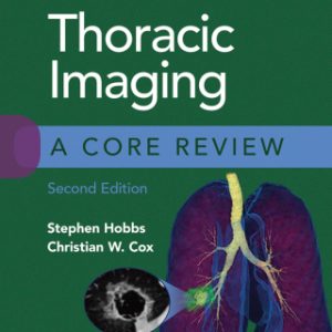 Thoracic Imaging: A Core Review 2nd Edition - Original PDF