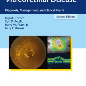 Vitreoretinal Disease 2nd Edition Diagnosis, Management, and Clinical Pearls - Original PDF