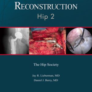 Advanced Reconstruction: Hip 2 - Original PDF