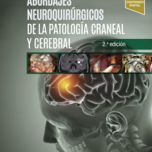 Abordajes neuroquirúrgicos de la patología craneal y cerebral 2nd Edition - Original PDF