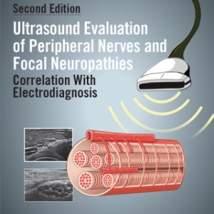 Ultrasound Evaluation of Peripheral Nerves and Focal Neuropathies, Second Edition 2nd Edition Correlation With Electrodiagnosis - Original PDF