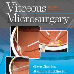 Vitreous Microsurgery 6th Edition - Original PDF