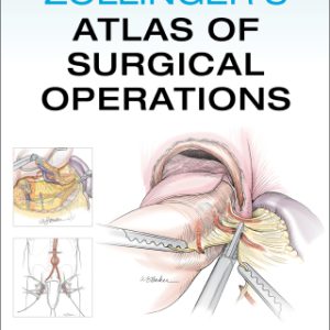 Zollinger's Atlas of Surgical Operations 11th Edition - Original PDF