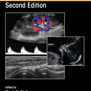 (Instant Download) Measurement in Ultrasound 2nd Edition - Original PDF