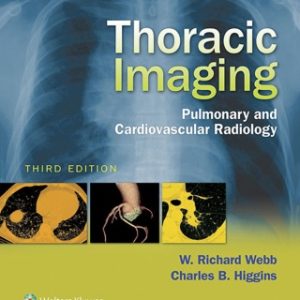 Thoracic Imaging: Pulmonary and Cardiovascular Radiology 3rd Edition - Original PDF