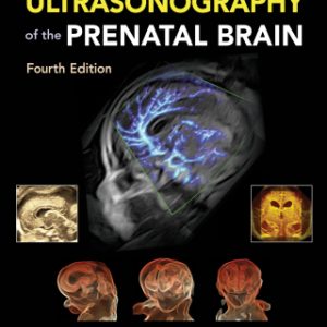 Timor's Ultrasonography of the Prenatal Brain 4th Edition - Original PDF