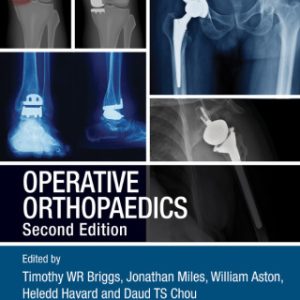 (Instant Download) Operative Orthopaedics 2nd Edition - Original PDF