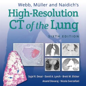 Webb, Müller and Naidich's High-Resolution CT of the Lung 6th Edition - Original PDF