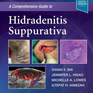 A Comprehensive Guide to Hidradenitis Suppurativa - Original PDF